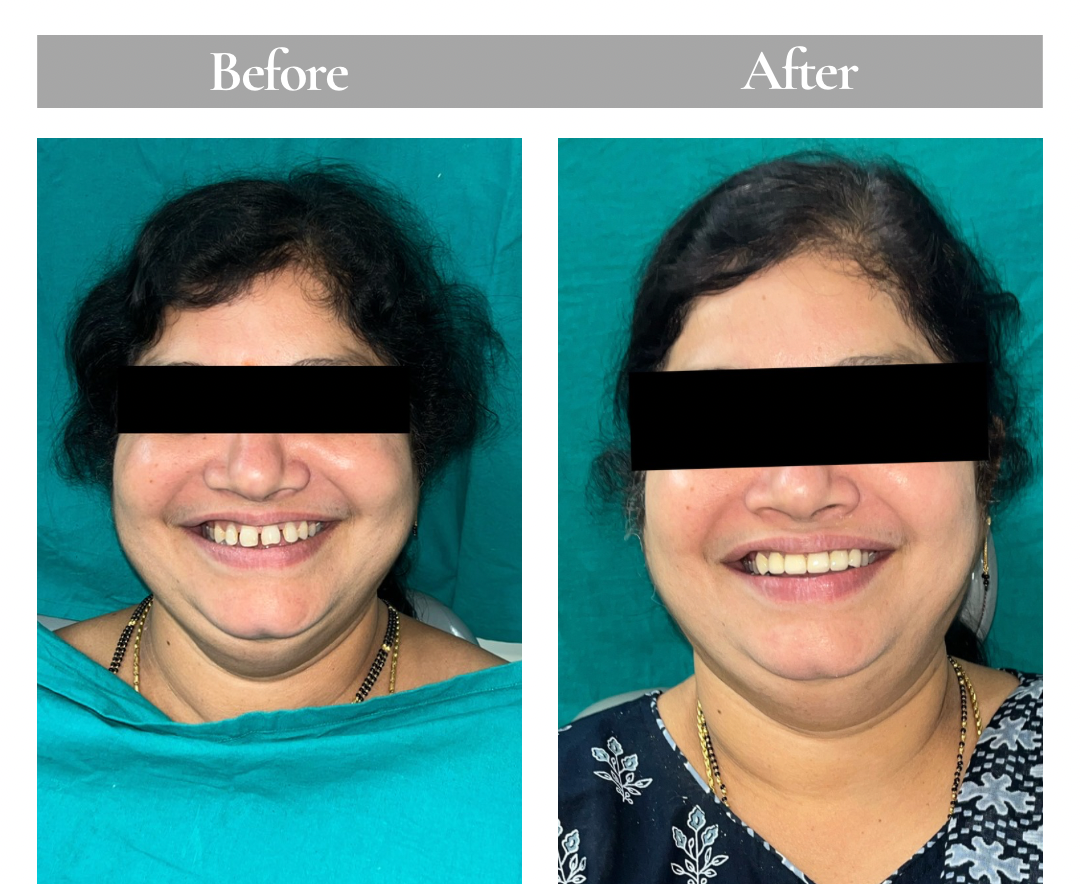 Patient Result 1