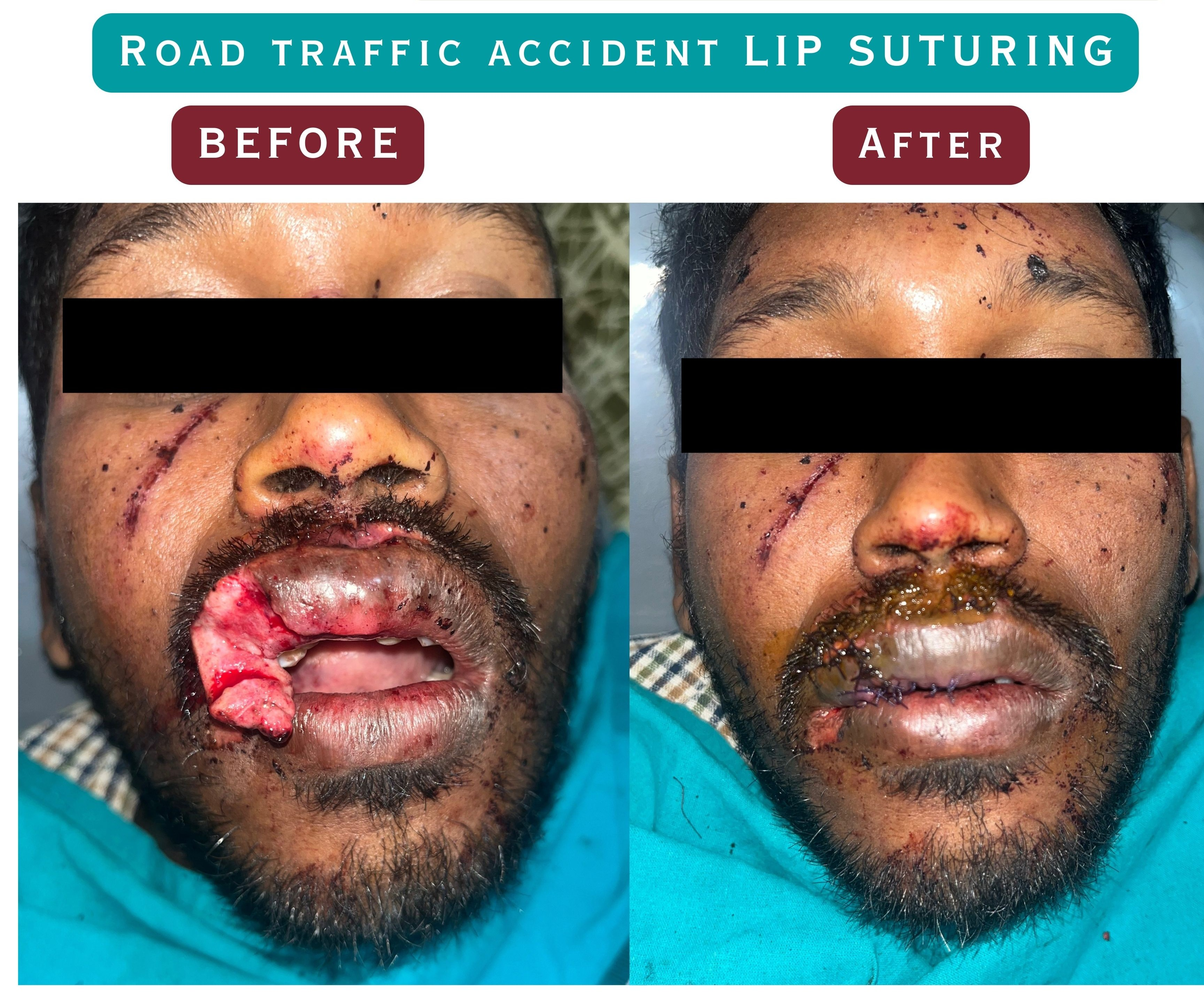 Patient Result 10