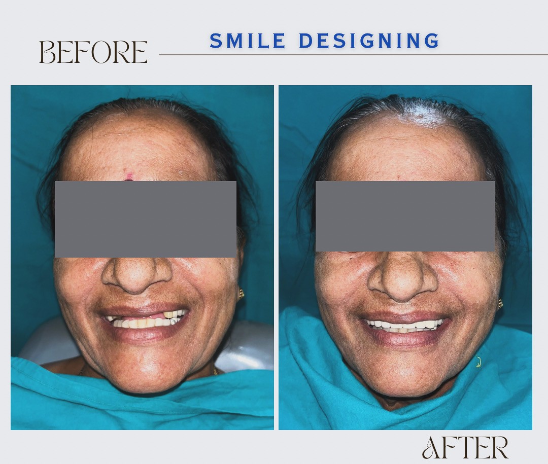 Patient Result 2