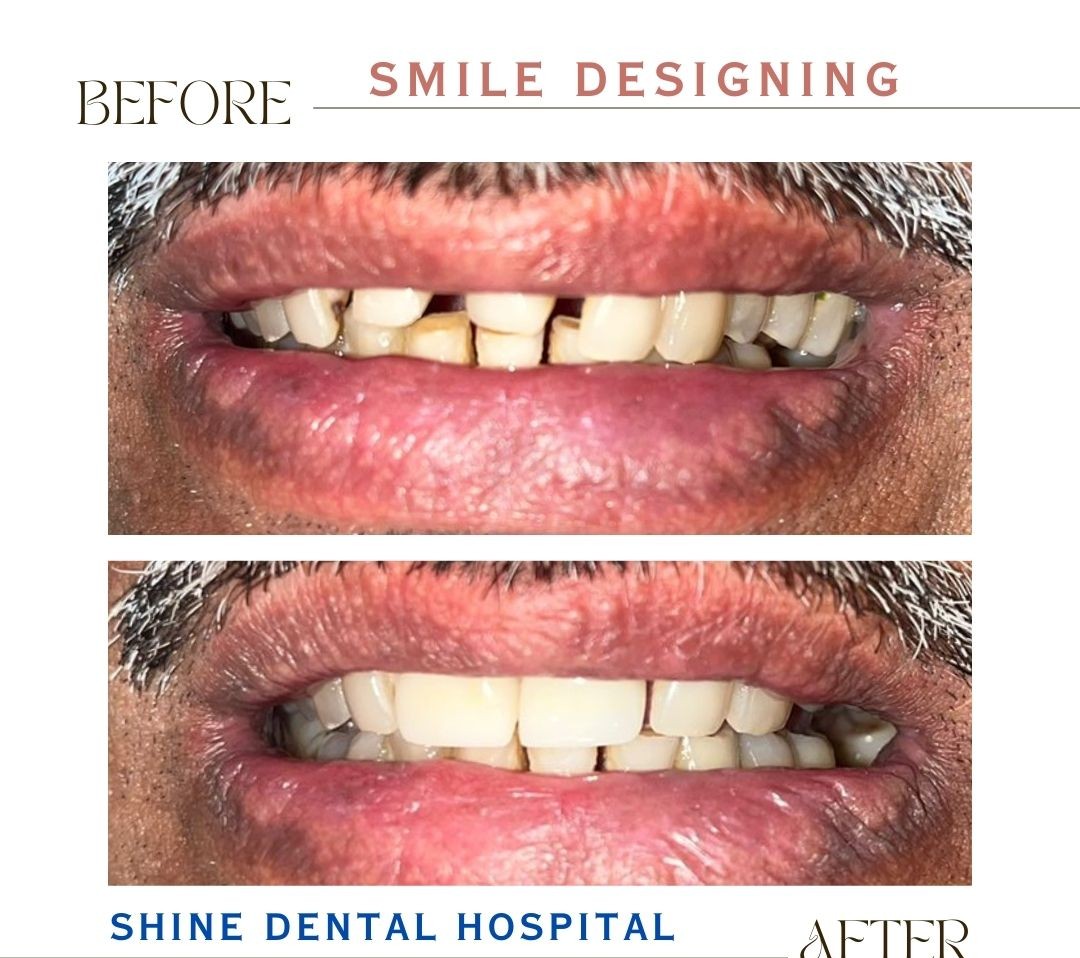 Patient Result 3