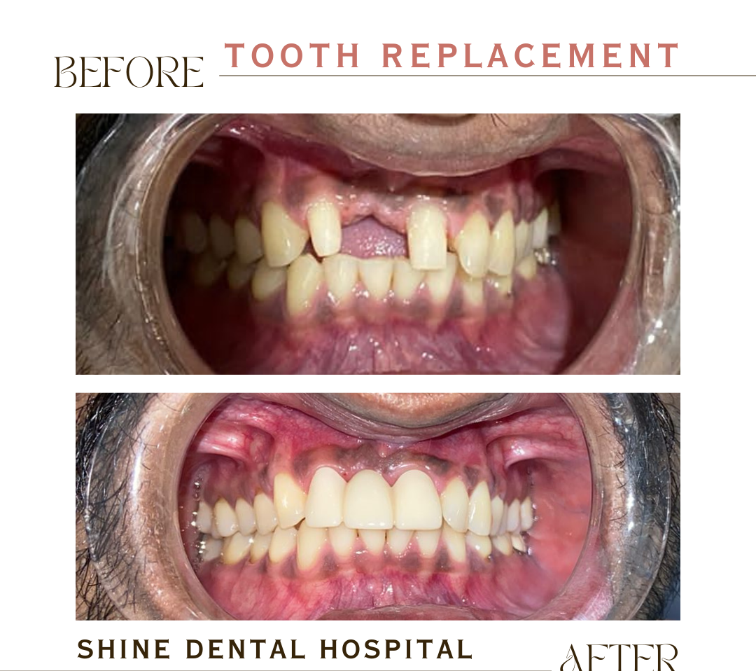 Patient Result 4