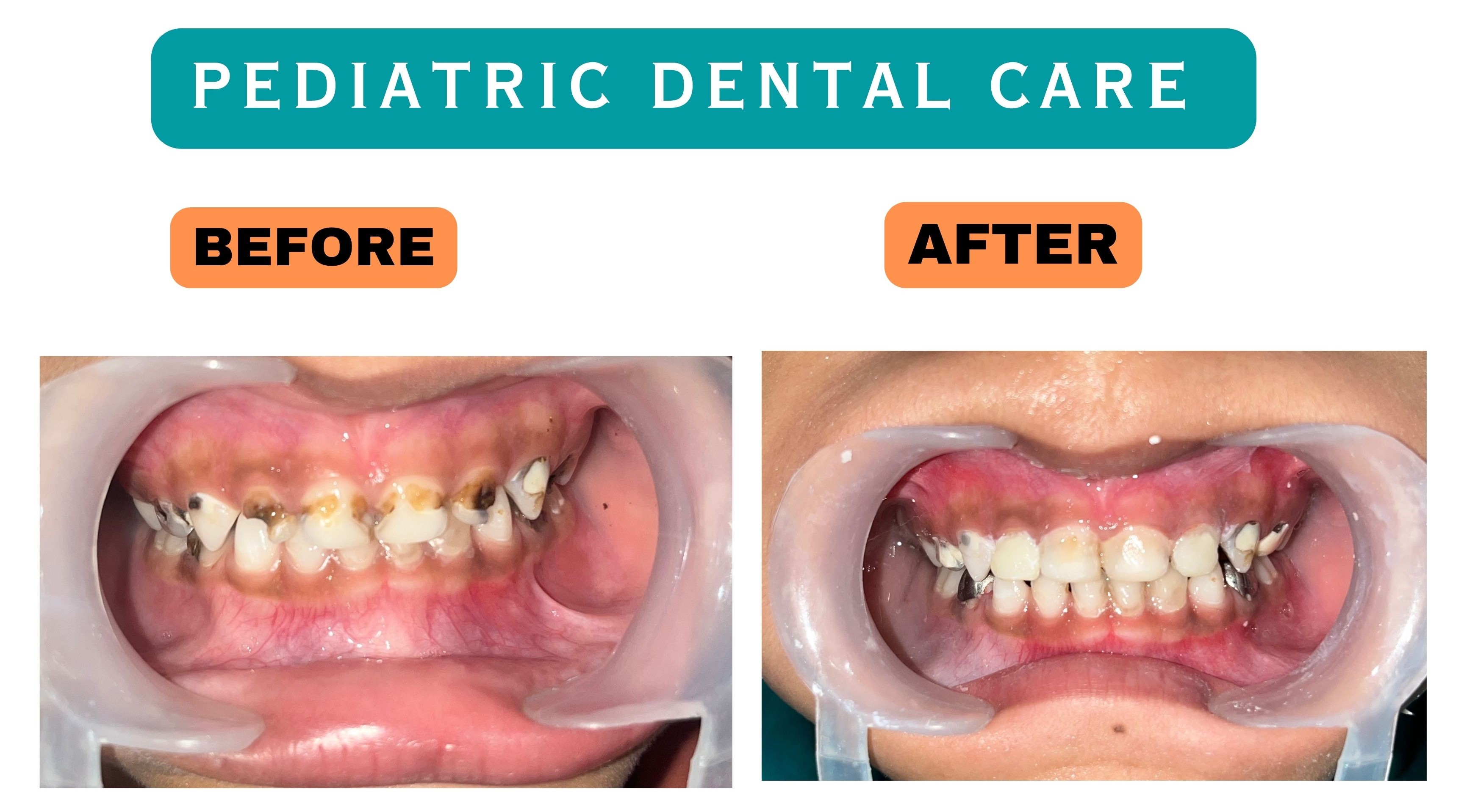 Patient Result 5