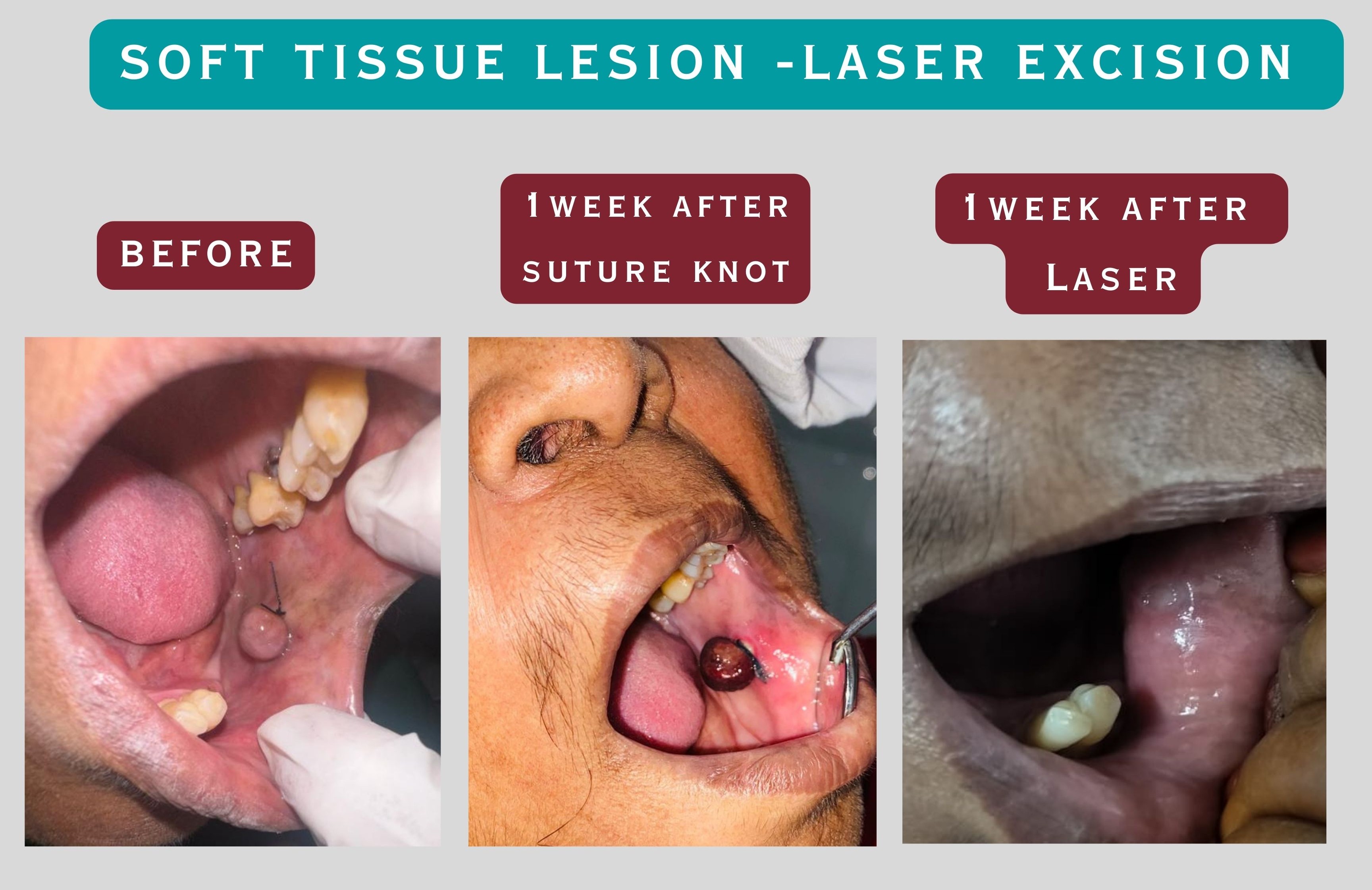 Patient Result 6