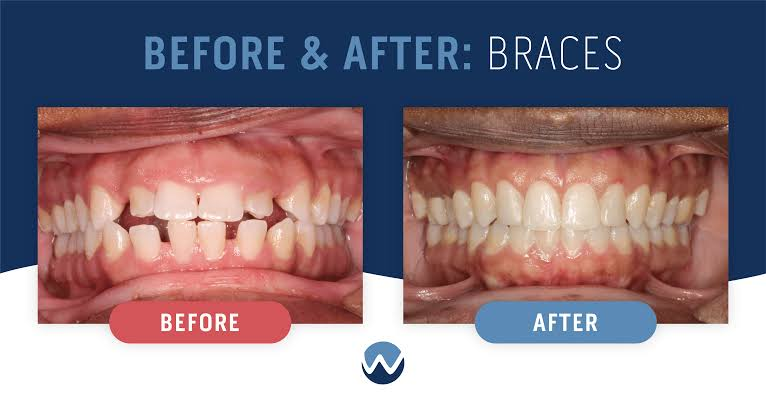 Patient Result 9